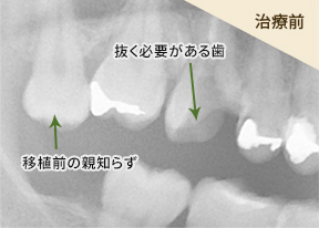 治療前